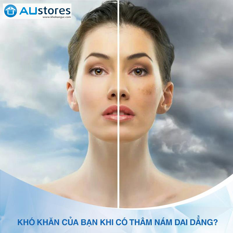 Kem trị nám và làm trắng da Lanopearl Himalaya Herbal Whitening Cream