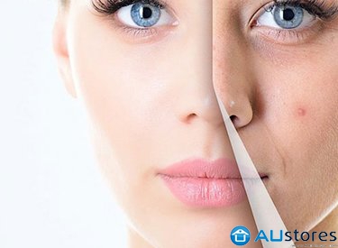 Uống tinh dầu hoa anh thảo có giúp giảm mụn không?