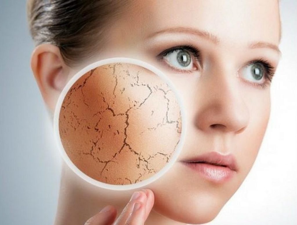 Da mặt khô: Bí quyết chọn sữa rửa mặt phù hợp
