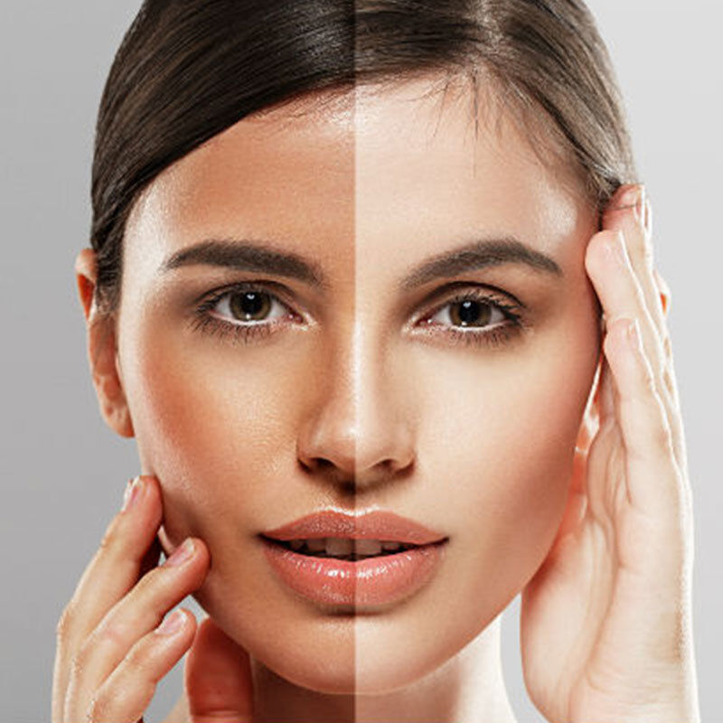 Da xỉn màu: Nỗi ám ảnh lớn nhất của phái đẹp